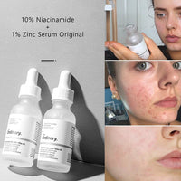 The Original Ordinary Niacinamide Face Serum